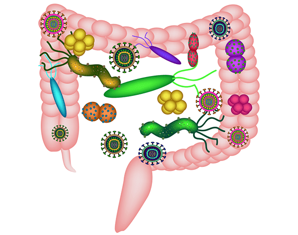 Processed Foods Cause Intestinal Imbalance